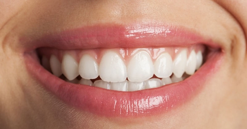 Healthy Teeth